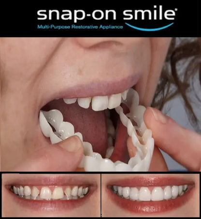 Snap On Smile Veneers Teeth For Men And Women Moldable False Artificial Braces Teeth with 2 pcs